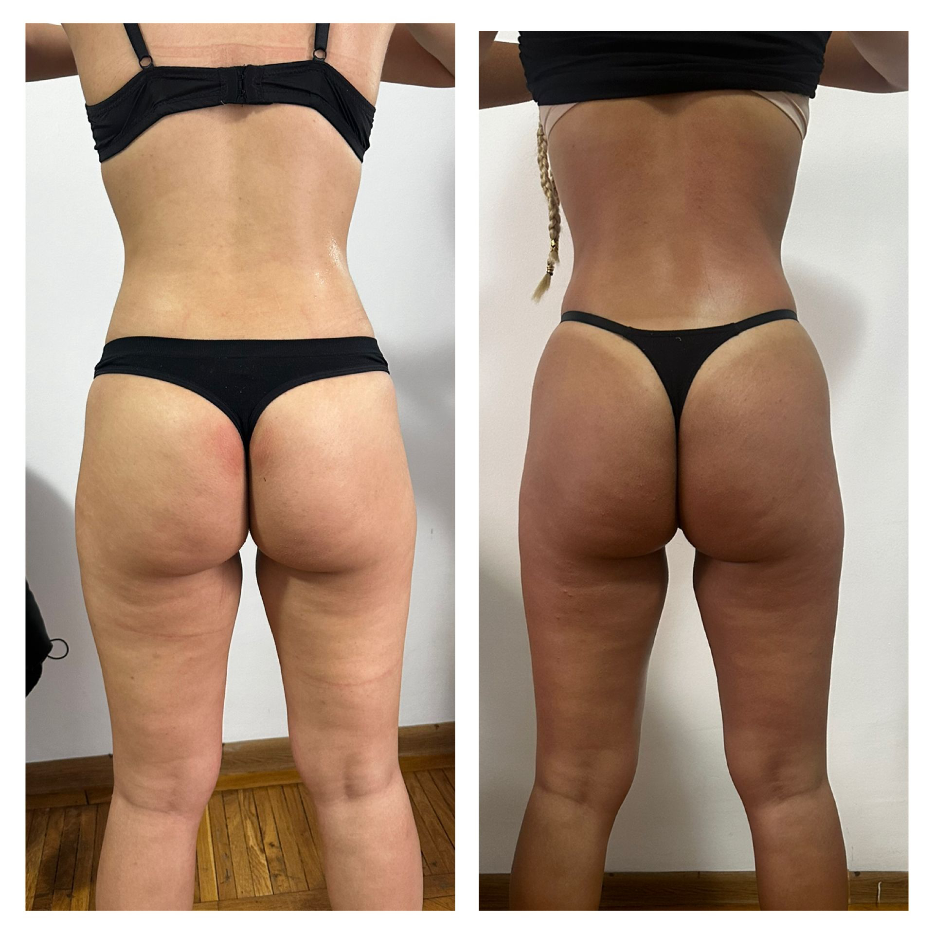 Remodelare – silueta completa